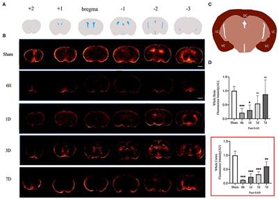 Dynamic Evolution of the Glymphatic System at the Early Stages of Subarachnoid Hemorrhage